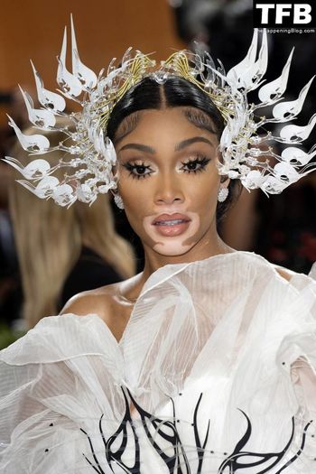 Winnie Harlow